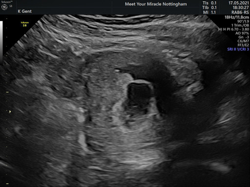 December babies 2021! Thread 3