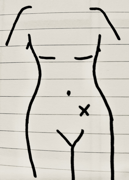 Burning pulling pain in left side of pelvis