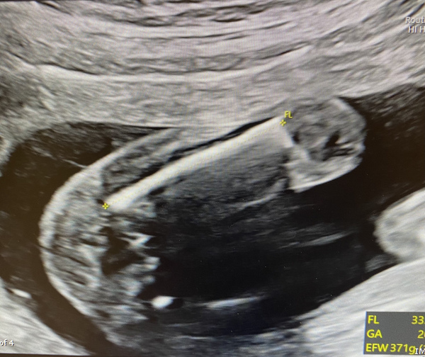 Gender guesses? Boy or girl?