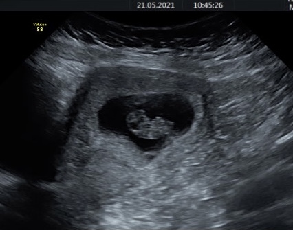 December babies 2021! Thread 4