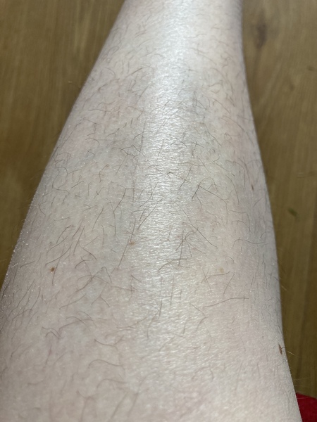 Would you shave these legs?