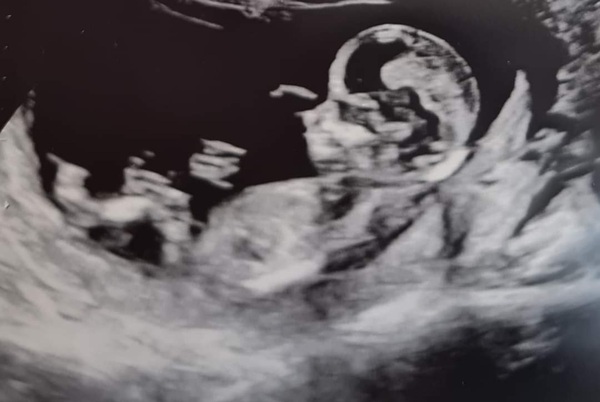 Do you want me to guess the sex? 12 week scans.