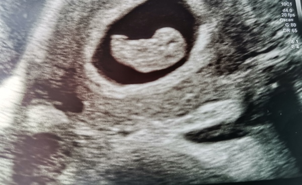 Christmas Baby's 2021