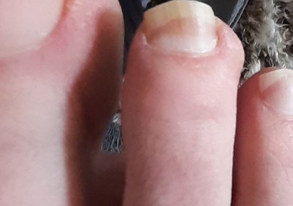 Something is worrying me, don't know whether to bother the GP.