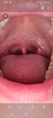 Is this normal?