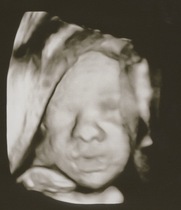 Due August 2021 - over half way!