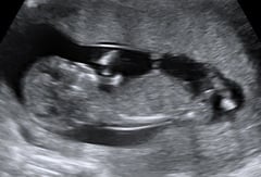 Gender guess?