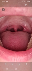 Is this normal?