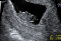 December babies 2021! Thread 3