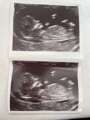 12+5 scan nub theories anyone??