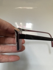Severe myopia (-12) in 2yo