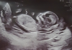 Due November 2021 - thread 2!