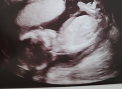 Any ideas if a boy or girl?