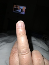 What is this on my finger