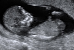 Gender guess?