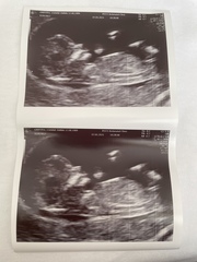 12+5 scan nub theories anyone??