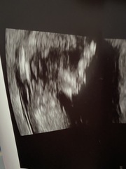 Girl or boy scan ???