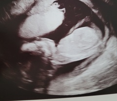 Any ideas if a boy or girl?