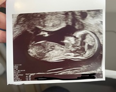 Gender guesses?? Nub theory, anyone?