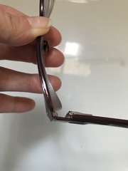 Severe myopia (-12) in 2yo