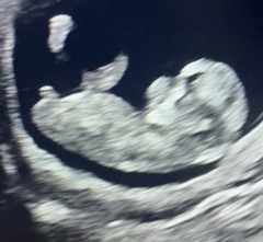 Nub guesses please!