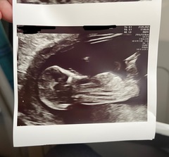 Gender guesses?? Nub theory, anyone?