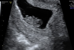 December babies 2021! Thread 3