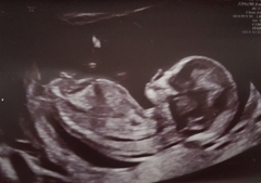 Due November 2021 - thread 2!
