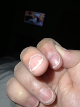 What is this on my finger