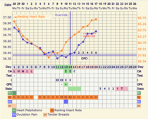 9DPO Symptom Spotting