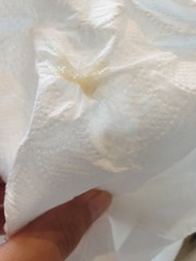 Is this my mucus plug? TMI..picture included!!!!