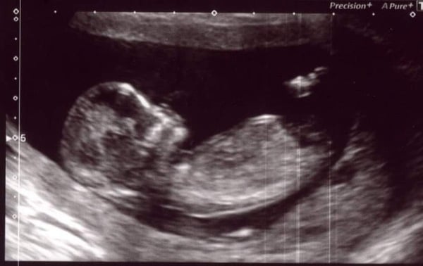 December babies 2021! Thread 4