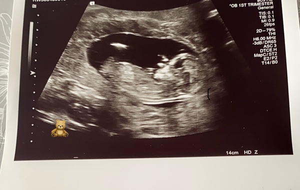 Boy or Girl?