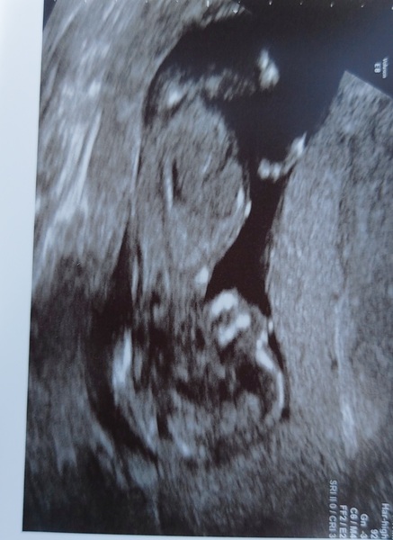 Boy or girl please guess