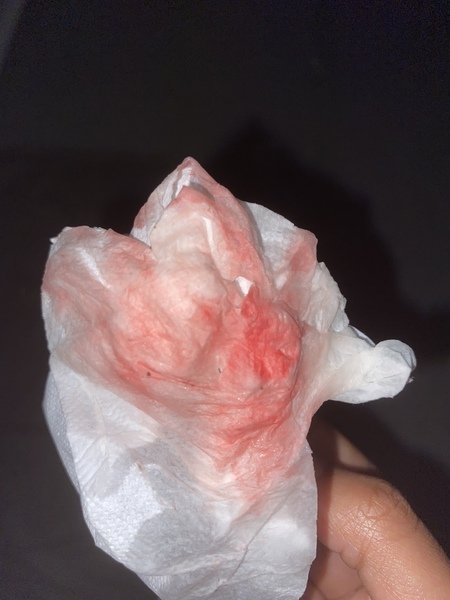 TMI/BLOOD WARNING!Bleeding during 6 weeks