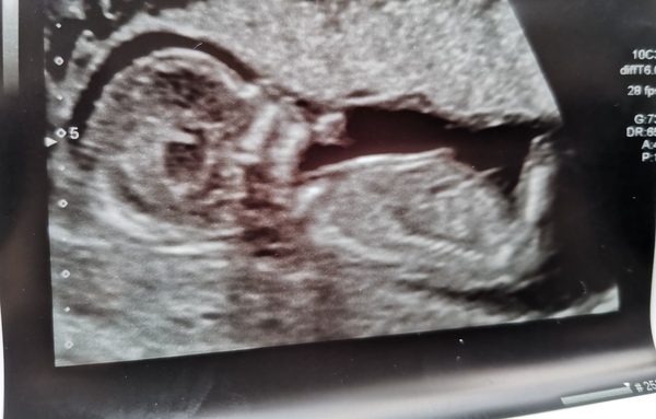 Boy or girl?!