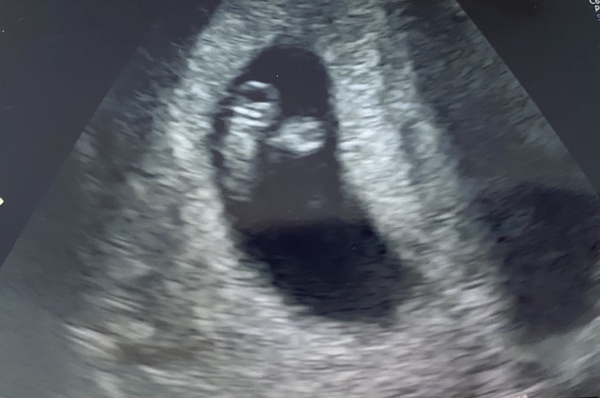 4 Weeks, First Pregnancy