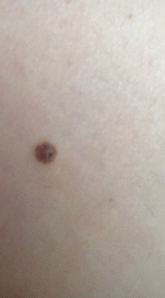 Should I see a dr