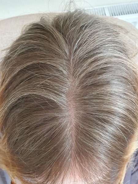 Grey hair - with pics