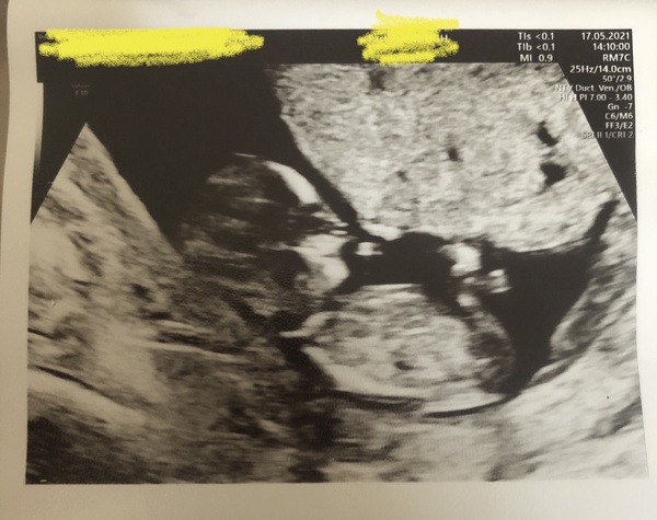 Boy or Girl? Just for fun!