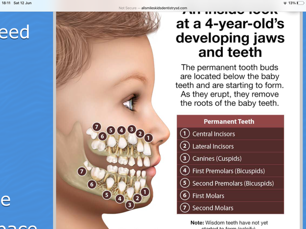 Freaking out!! DD’s teeth