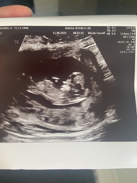 Any gender guesses? 12+3