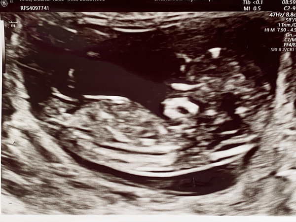 December babies 2021! Thread 4