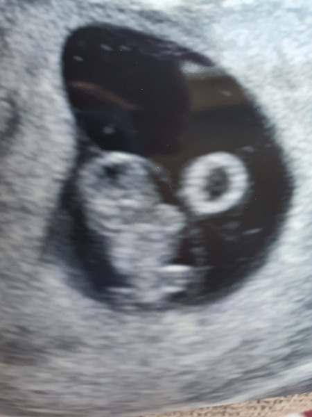 Due February 2022