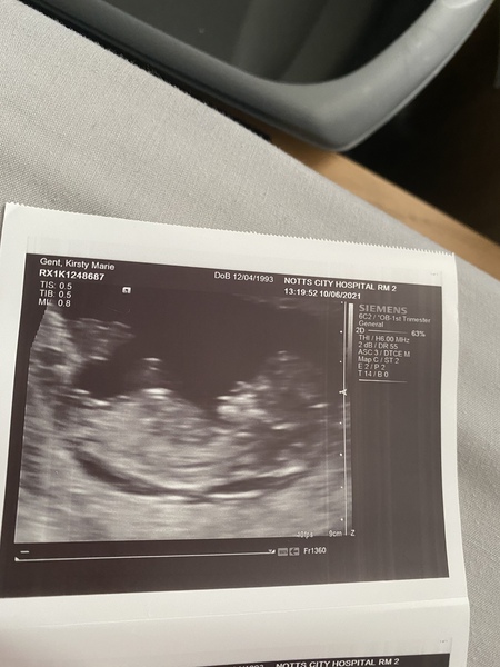 Gender guesses I enjoy these💙💕