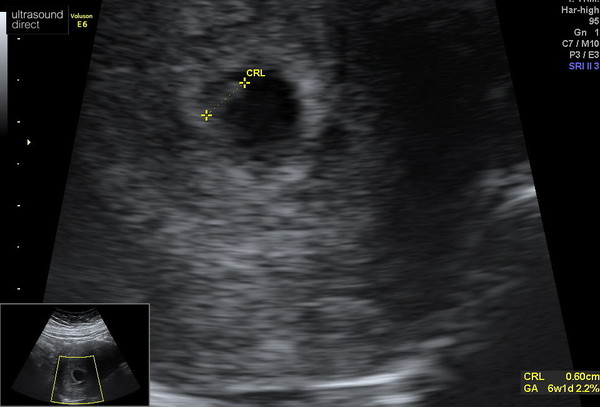 Due February 2022