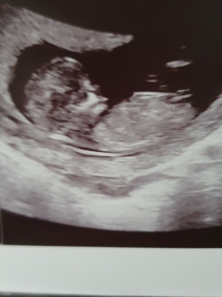 December babies 2021! Thread 4