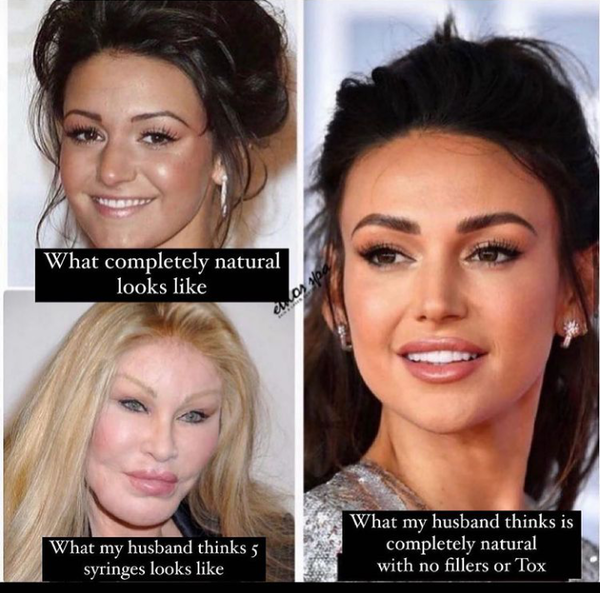 Husband said he will divorce me if I get Botox