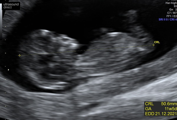 Gender guesses?
