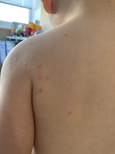 Spots! Any idea what these could be